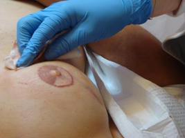 Permanent Nipple Tattoos - Breast Healing